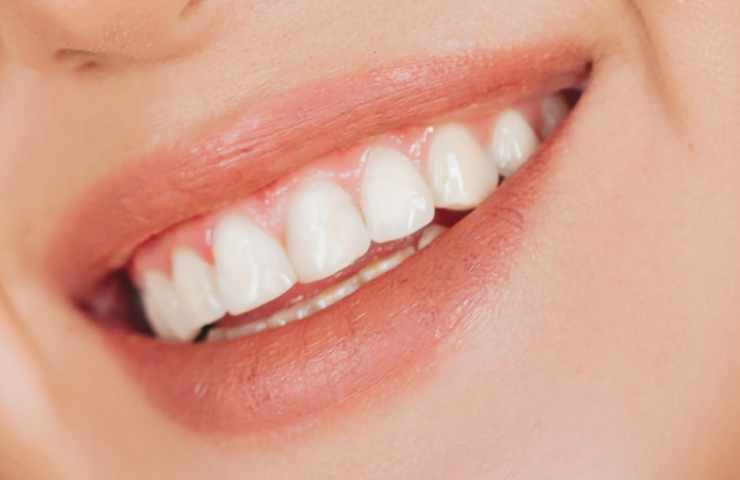 sbiancare denti sembrare più giovane